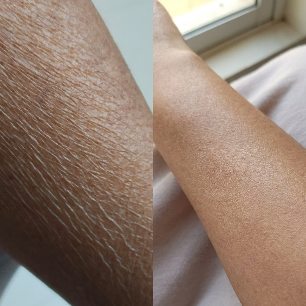 Skin texture before and after using Pershibu