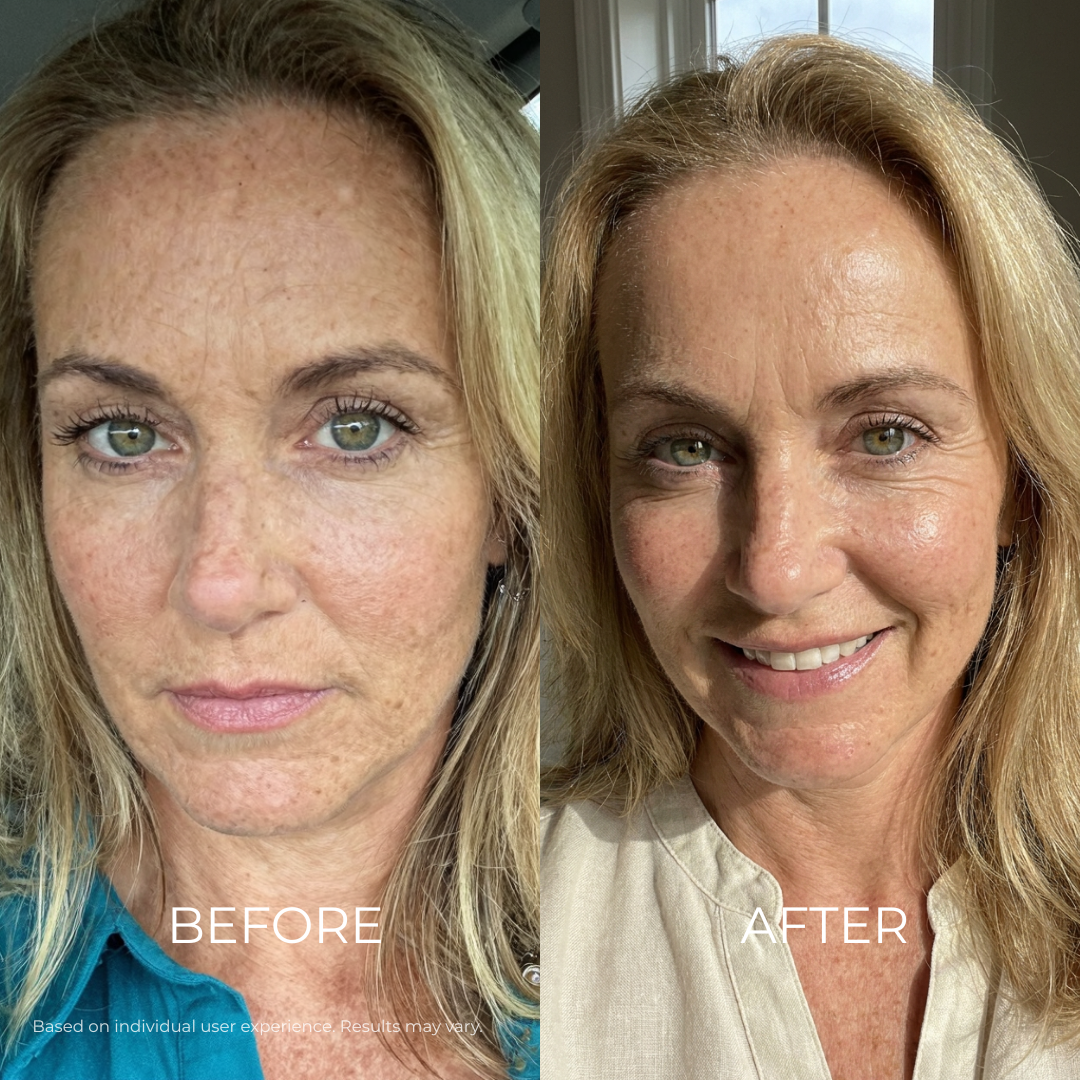 Dark Spots